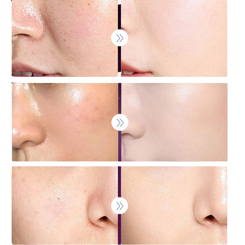 Crema Noble de lujo para mujer - Skincare Luxury Whitening reseña y precio